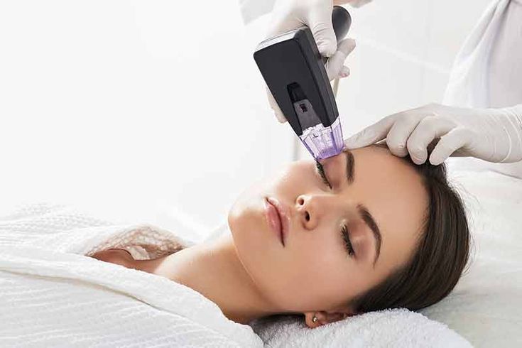 Say Goodbye to Acne Scars: The Best Resurfacing Treatments That Actually Work